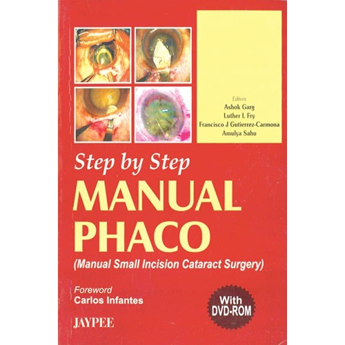 STEP BY STEP MANUAL PHACO WITH DVD-ROM