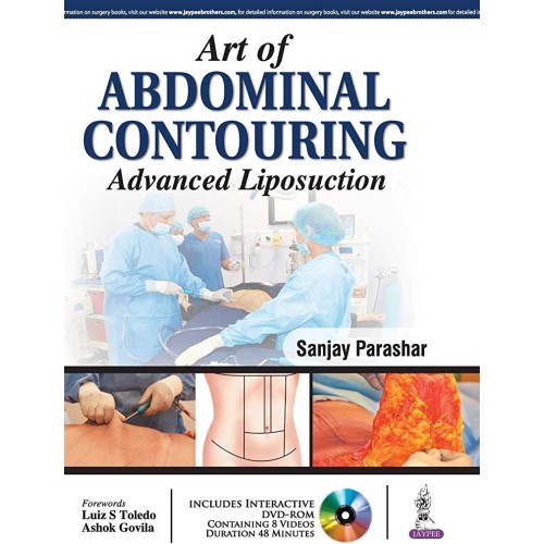 ART OF ABDOMINAL CONTOURING ADVANCED LIPOSUCT...