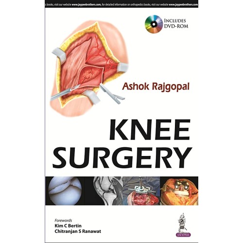 KNEE SURGERY INCLUDES DVD-ROM