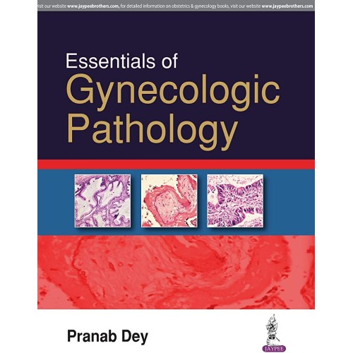 ESSENTIALS OF GYNECOLOGIC PATHOLOGY