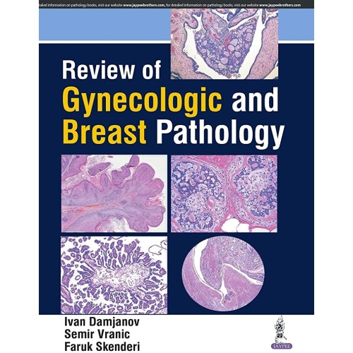 REVIEW OF GYNECOLOGIC AND BREAST PATHOLOGY