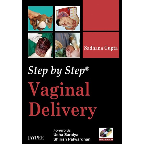 STEP BY STEP VAGINAL DELIVERY WITH DVD-ROM