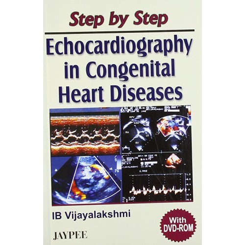 STEP BY STEP ECHOCARDIOGRAPHY IN CONGENITAL H...