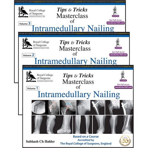 TIPS & TRICKS MASTERCLASS OF INTRAMEDULLARY N...