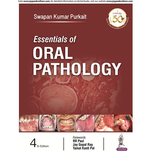 ESSENTIALS OF ORAL PATHOLOGY