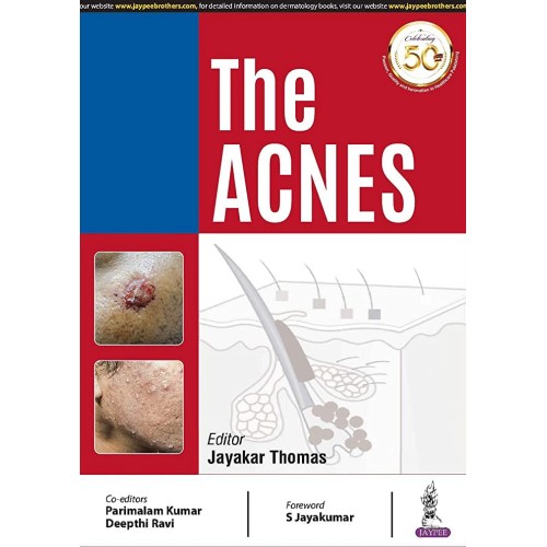 THE ACNES