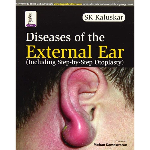 DISEASES OF THE EXTERNAL EAR (INCLUDING STEP-BY-STEP OTOPLASTY)