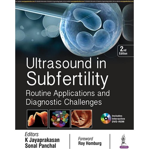 ULTRASOUND IN SUBFERTILITY ROUTINE APPLICATIO...