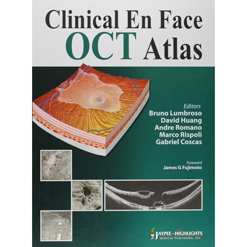 CLINICAL EN FACE OCT ATLAS