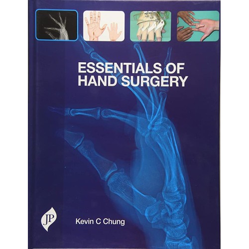 ESSENTIALS OF HAND SURGERY