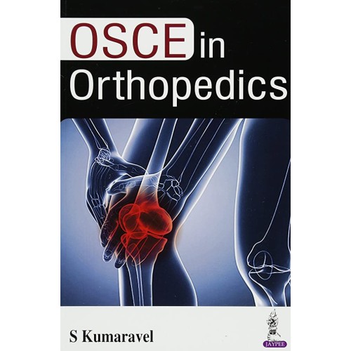 OSCE IN ORTHOPEDICS