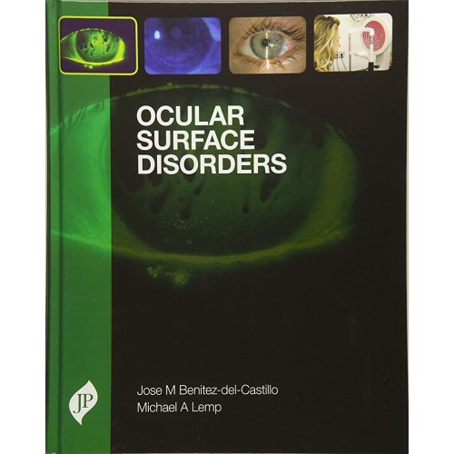 OCULAR SURFACE DISORDERS