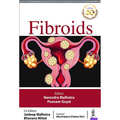 FIBROIDS