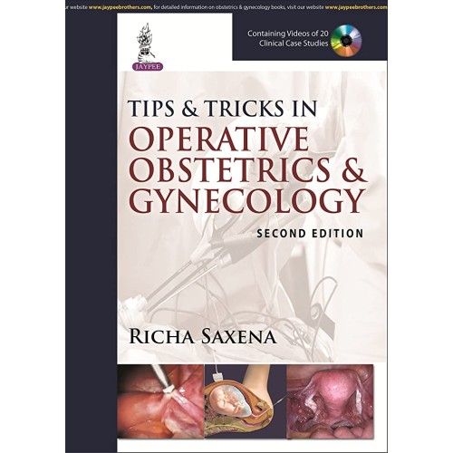 TIPS & TRICKS IN OPERATIVE OBSTETRICS & GYNEC...