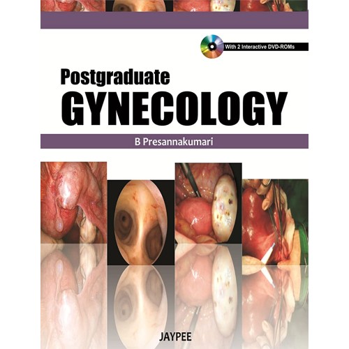 POSTGRADUATE GYNAECOLOGY WITH DVD ROM