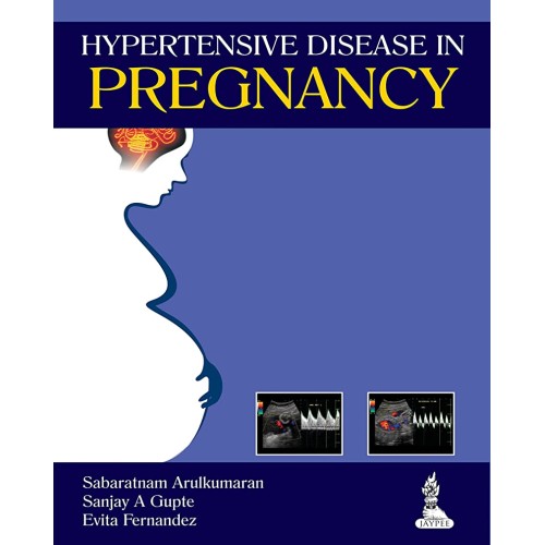 HYPERTENSIVE DISEASE IN PREGNANCY