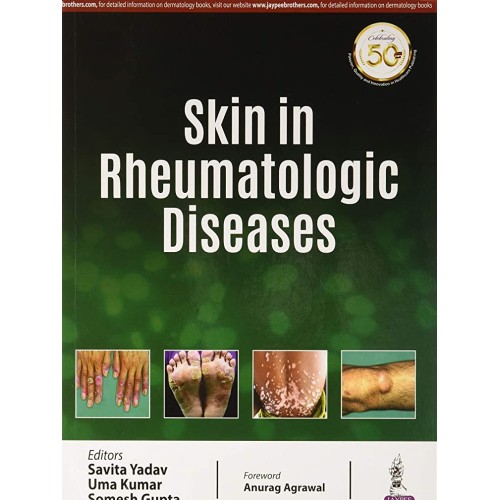 SKIN IN RHEUMATOLOGIC DISEASES