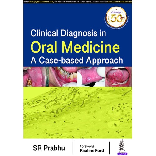 CLINICAL DIAGNOSIS IN ORAL MEDICINE: A CASE-BASED APPROACH