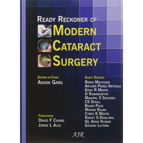 READY RECKONER OF MODERN CATARACT SURGERY