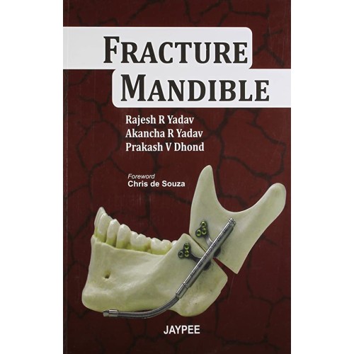 FRACTURE MANDIBLE