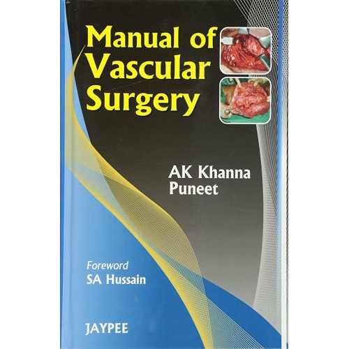 MANUAL OF VASCULAR SURGERY