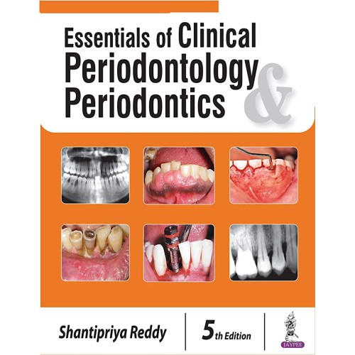 ESSENTIALS OF CLINICAL PERIODONTOLOGY PERIODONTICS WITH CD-ROM FREE-MANUAL OF CLINICAL PERIODO