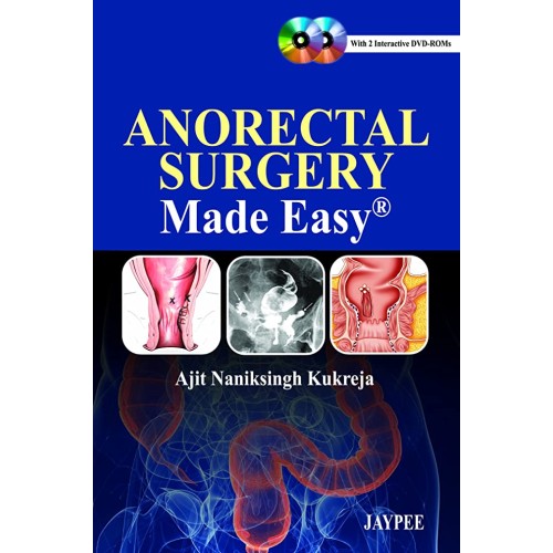 ANORECTAL SURGERY MADE EASY WITH DVD-ROMS