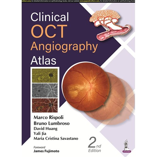 CLINICAL OCT ANGIOGRAPHY ATLAS