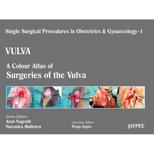 VULVA-1: A.C.A.OF SURGERIES OF THE VULVA (SSP...