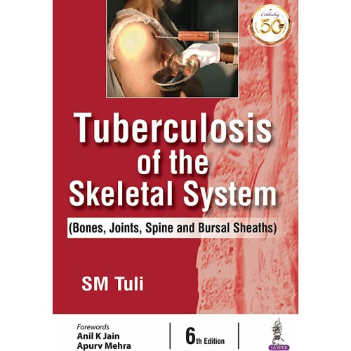 TUBERCULOSIS OF THE SKELETAL SYSTEM (BONES, J...