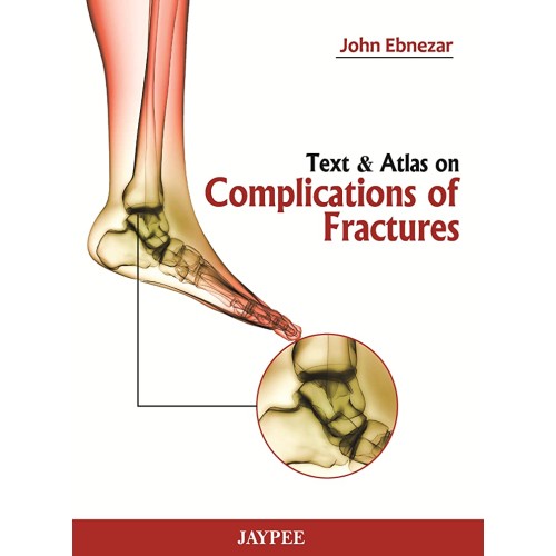 TEXT & ATLAS ON COMPLICATIONS OF FRACTURES