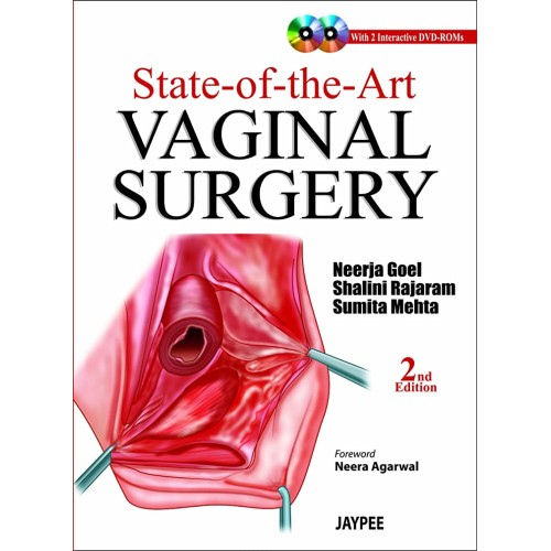 STATE-OF-THE ART VAGINAL SURGERY WITH 2-INTER...