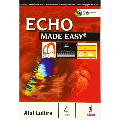 ECHO MADE EASY WITH CD-ROM