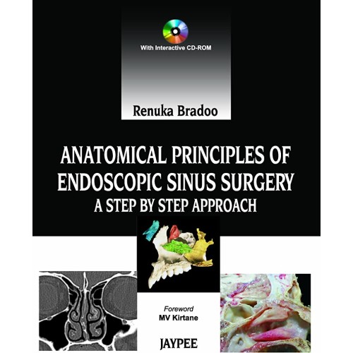 ANATOMICAL PRINCIPLES OF ENDOSCOPIC SINUS SUR...