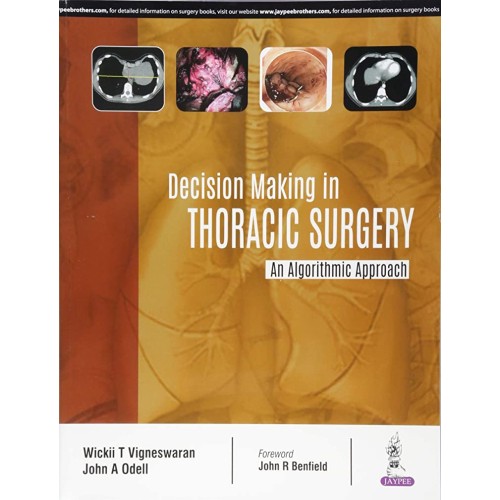 DECISION MAKING IN THORACIC SURGERY AN ALGORITHMIC APPROACH