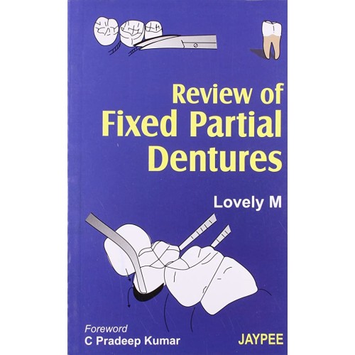 REVIEW OF FIXED PARTIAL DENTURES