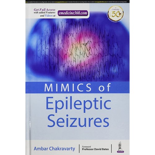 MIMICS OF EPILEPTIC SEIZURES