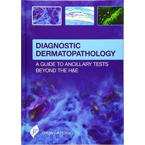 DIAGNOSTIC DERMATOPATHOLOGY:A GUIDE TO ANCILLARY TESTS BEYOND THE H&E