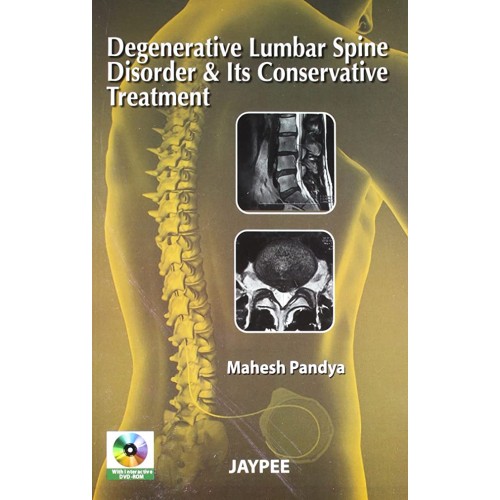 DEGENERATIVE LUMBAR SPINE DISORDER & ITS CONSERVATIVE TREATMENT WITH DVD-ROM