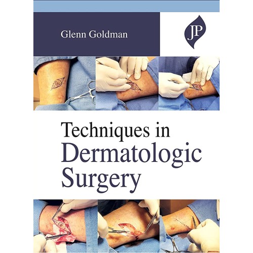 TECHNIQUES IN DERMATOLOGIC SURGERY