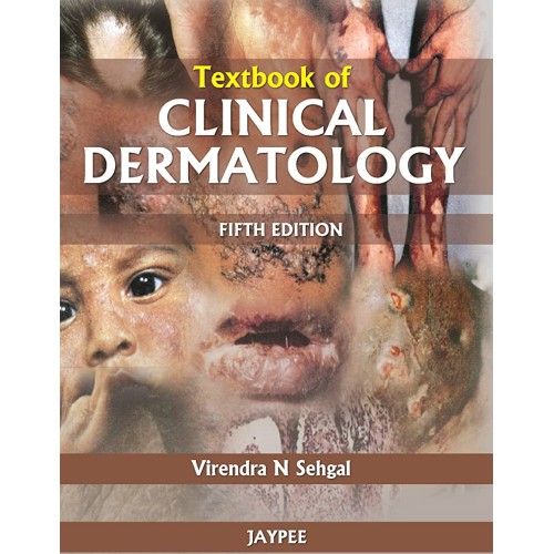 TEXTBOOK OF CLINICAL DERMATOLOGY