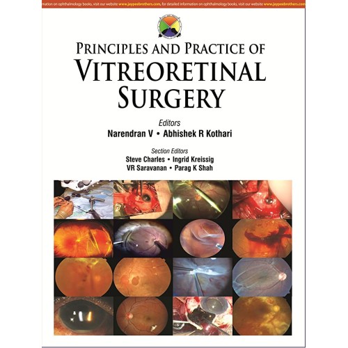 PRINCIPLES AND PRACTICE OF VITREORETINAL SURG...