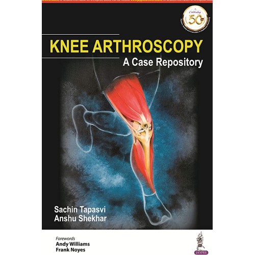 KNEE ARTHROSCOPY: A CASE REPOSITORY