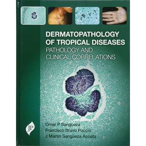 DERMATOPATHOLOGY OF TROPICAL DISEASES PATHOLO...