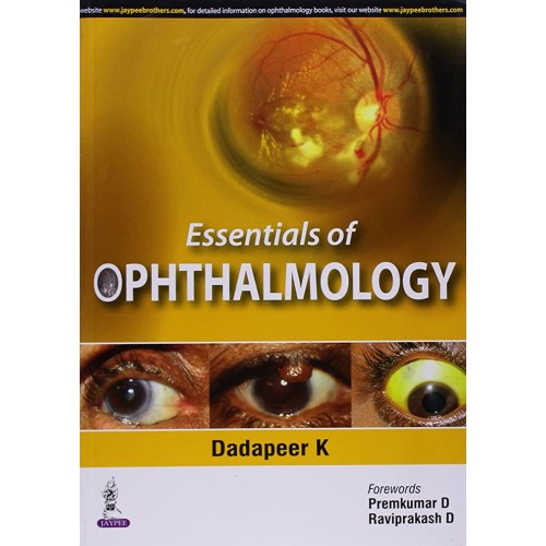 ESSENTIALS OF OPHTHALMOLOGY