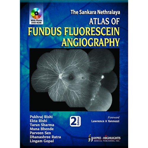 THE SANKARA NETHRALAYA ATLAS OF FUNDUS FLUORE...