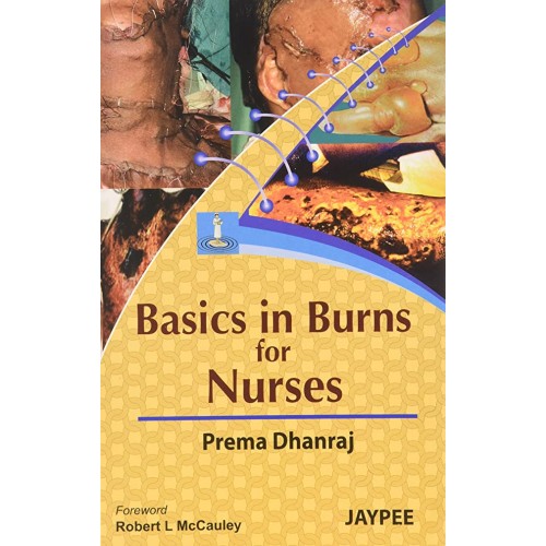 BASICS IN BURNS FOR NURSES