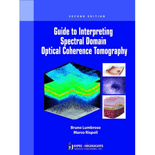 GUIDE TO INTERPRETING SPECTRAL DOMAIN OPTICAL COHERENCE TOMOGRAPHY