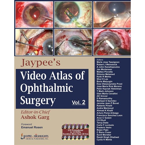 JAYPEE'S VIDEO ATLAS OF OPHTHALMIC SURGERY VO...