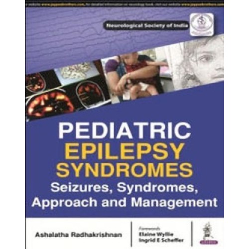 PEDIATRIC EPILEPSY SYNDROMES SEIZURES, SYNDRO...